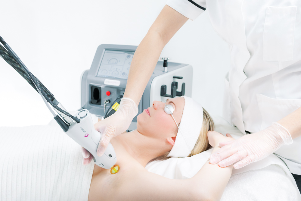 Laser Hair Removal with the Syneron Candela Gentle Lase - DuBois